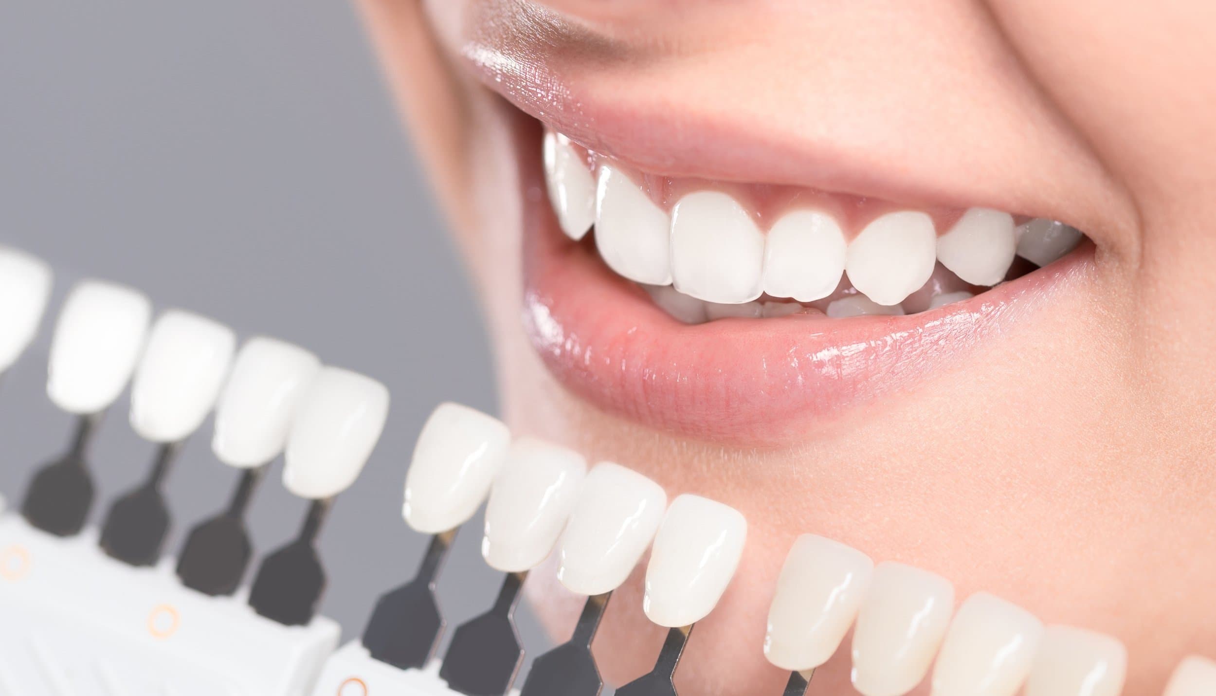A close-up of a bright, white smile, illustrating professional teeth whitening at Align Dental Surgery, Orchard Road
