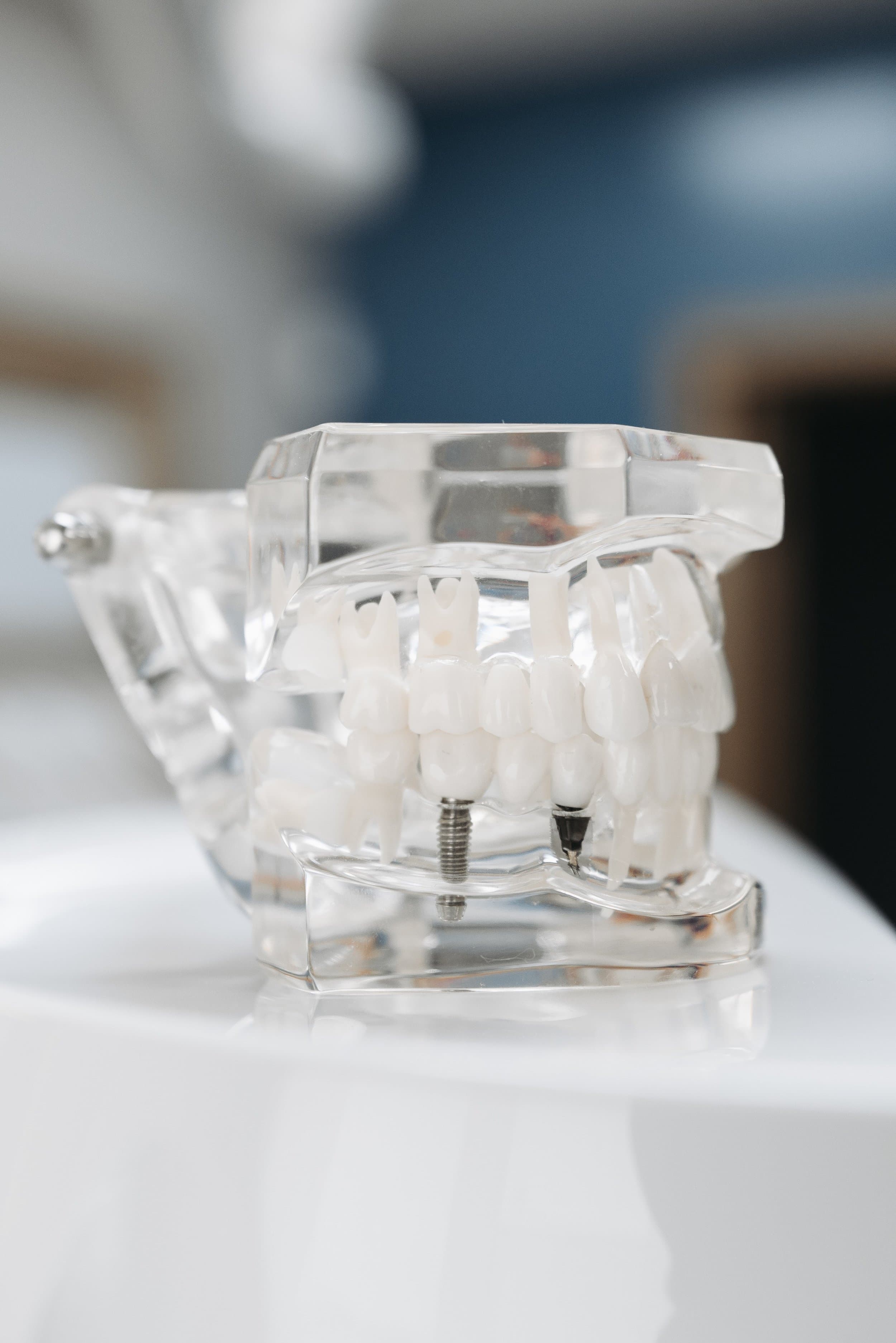 Dental implants used to replace missing teeth at Align Dental Surgery