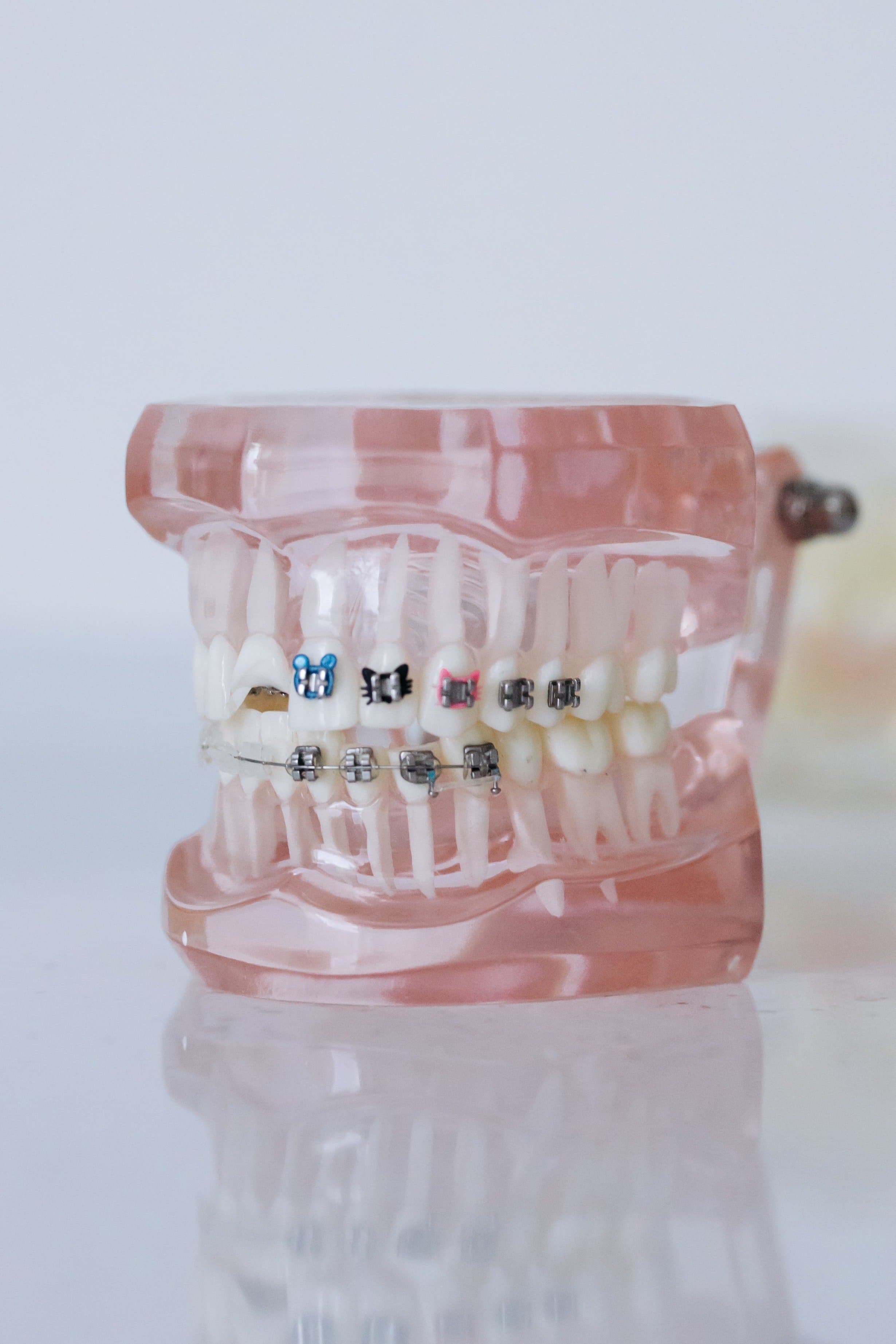 A dentist demonstrating braces on a teeth model at Align Dental Surgery