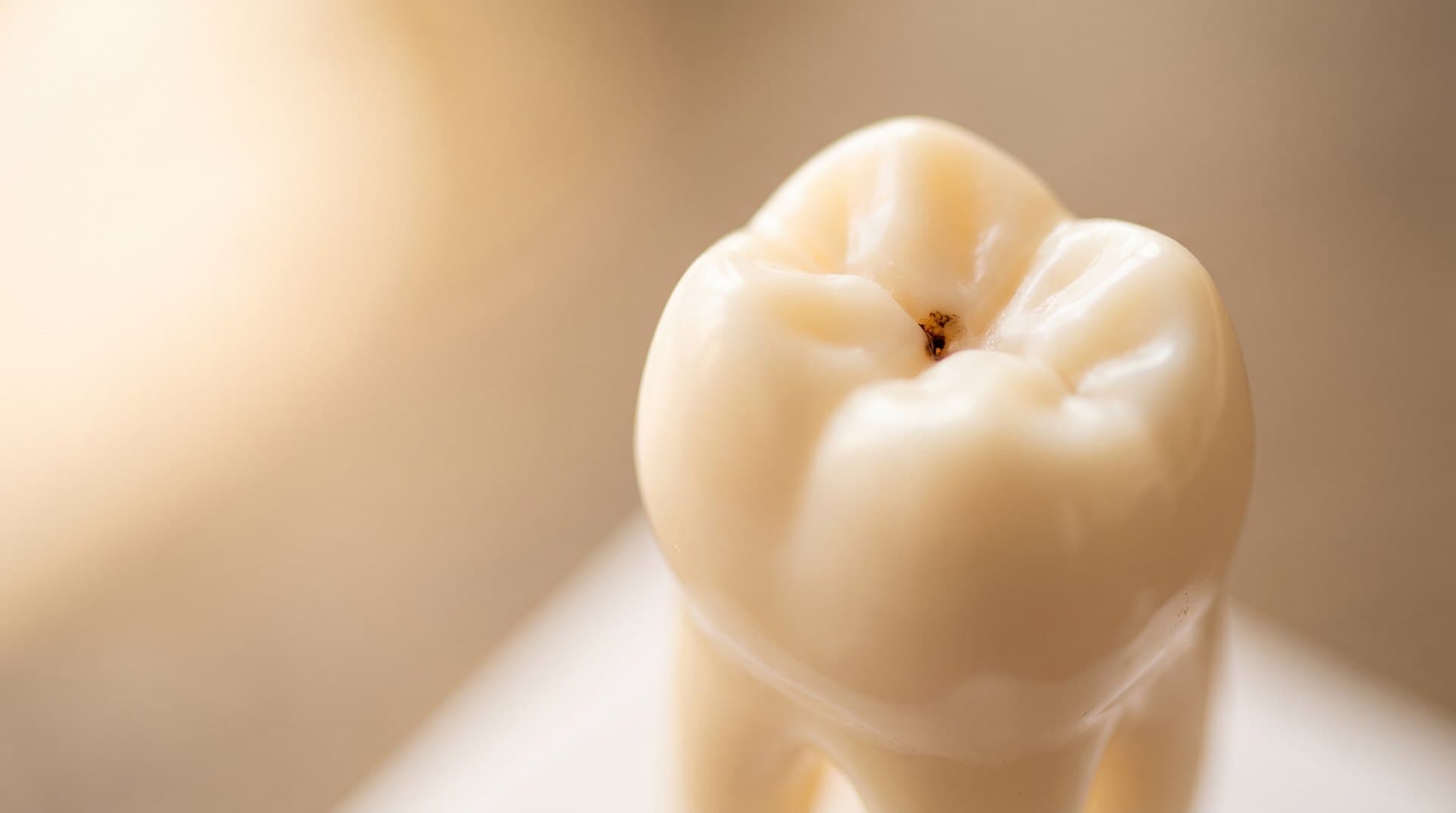 A close-up of a tooth with a small dark spot of early decay in one of its grooves