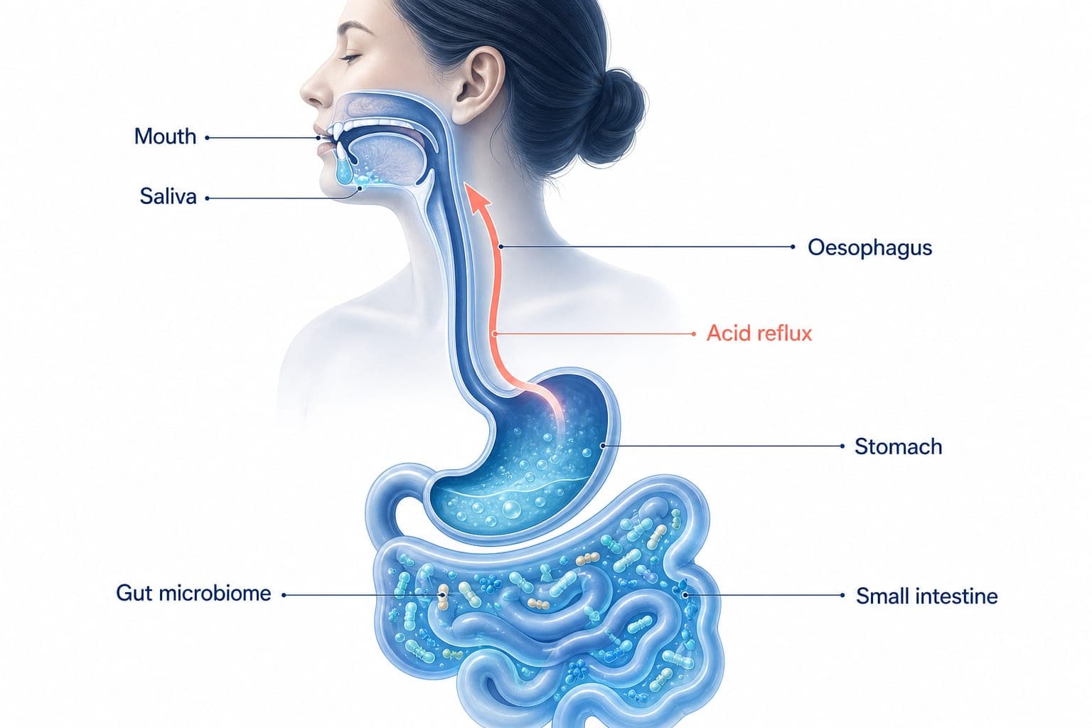A labelled diagram of the digestion pathway from the mouth and saliva down the oesophagus to the stomach and small intestine, with an arrow showing acid reflux travelling back up towards the mouth