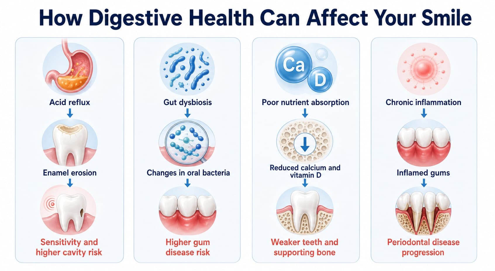 How digestive health can affect your smile: an infographic showing acid reflux leading to enamel erosion and sensitivity, gut dysbiosis changing oral bacteria and gum disease risk, poor nutrient absorption weakening teeth and supporting bone, and chronic inflammation contributing to periodontal disease progression