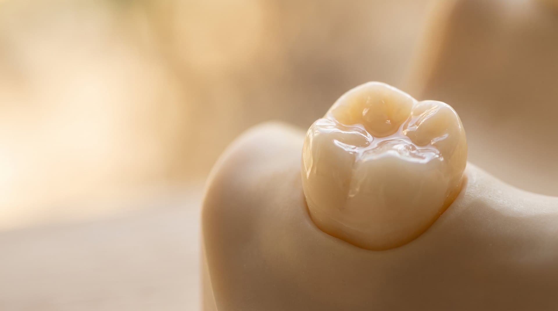 A close-up of a back molar with a thin protective sealant over its grooved chewing surface