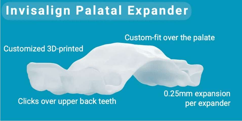The Invisalign Palatal Expander appliance and its key features, at Align Dental Surgery