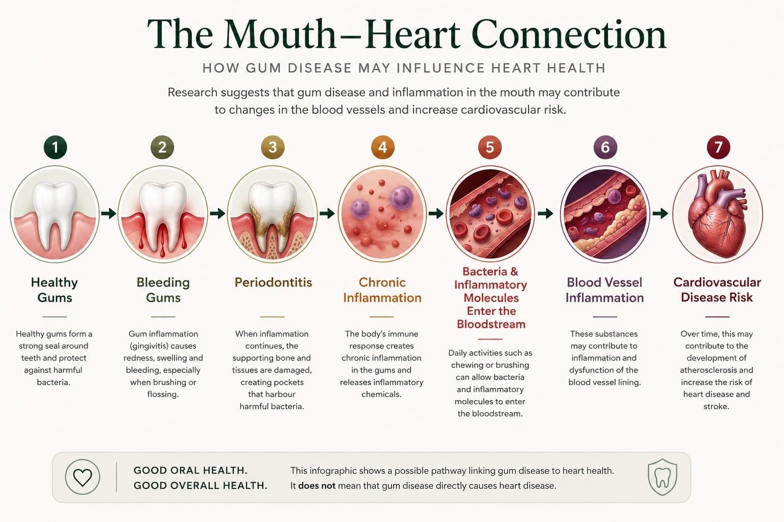 The mouth-heart connection: an infographic showing the pathway from healthy gums to bleeding gums, periodontitis, chronic inflammation, bacteria entering the bloodstream, blood vessel inflammation and cardiovascular disease risk. It notes this is a possible pathway and does not mean gum disease directly causes heart disease.