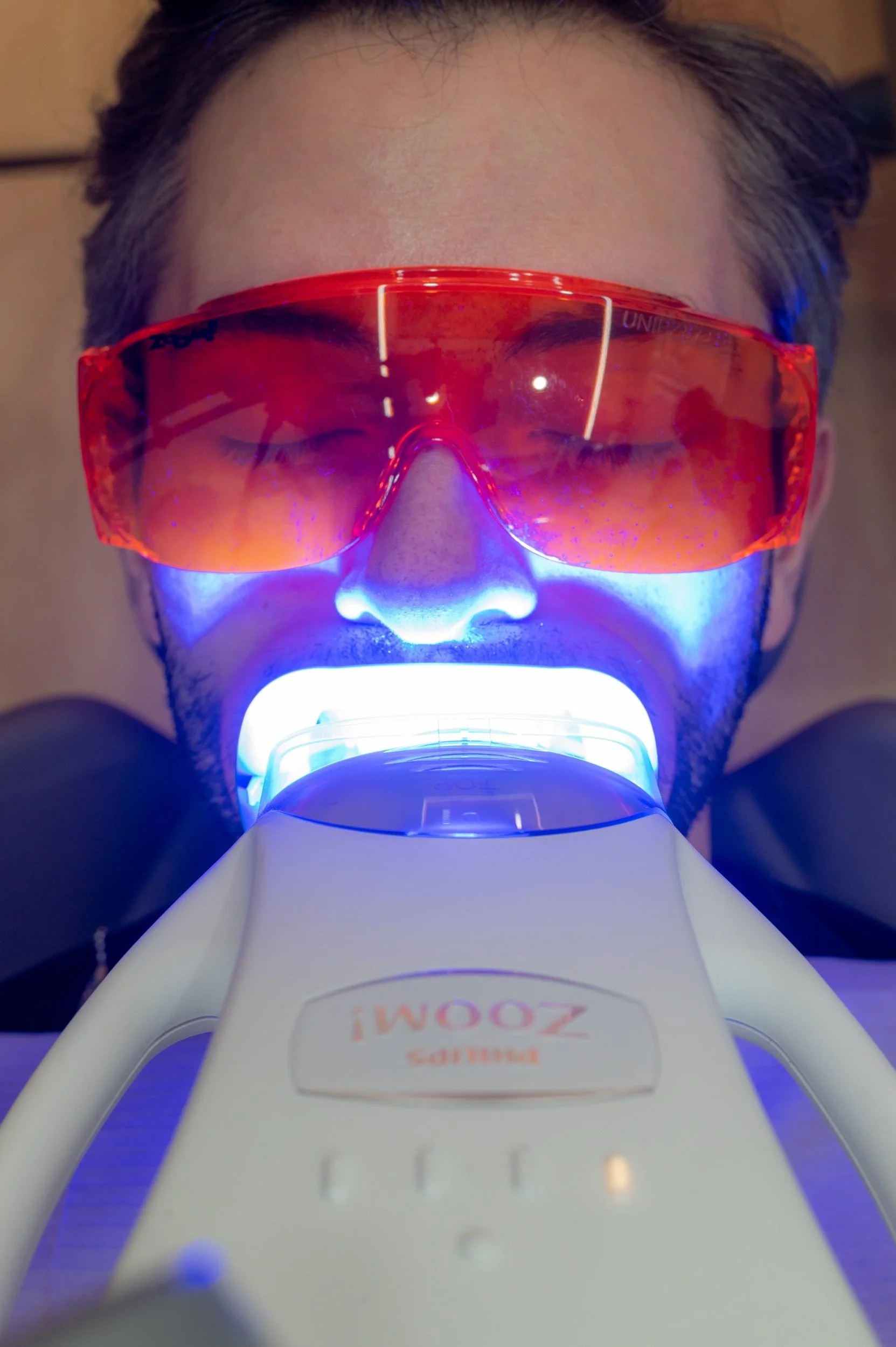 In-clinic Philips Zoom teeth whitening at Align Dental Surgery