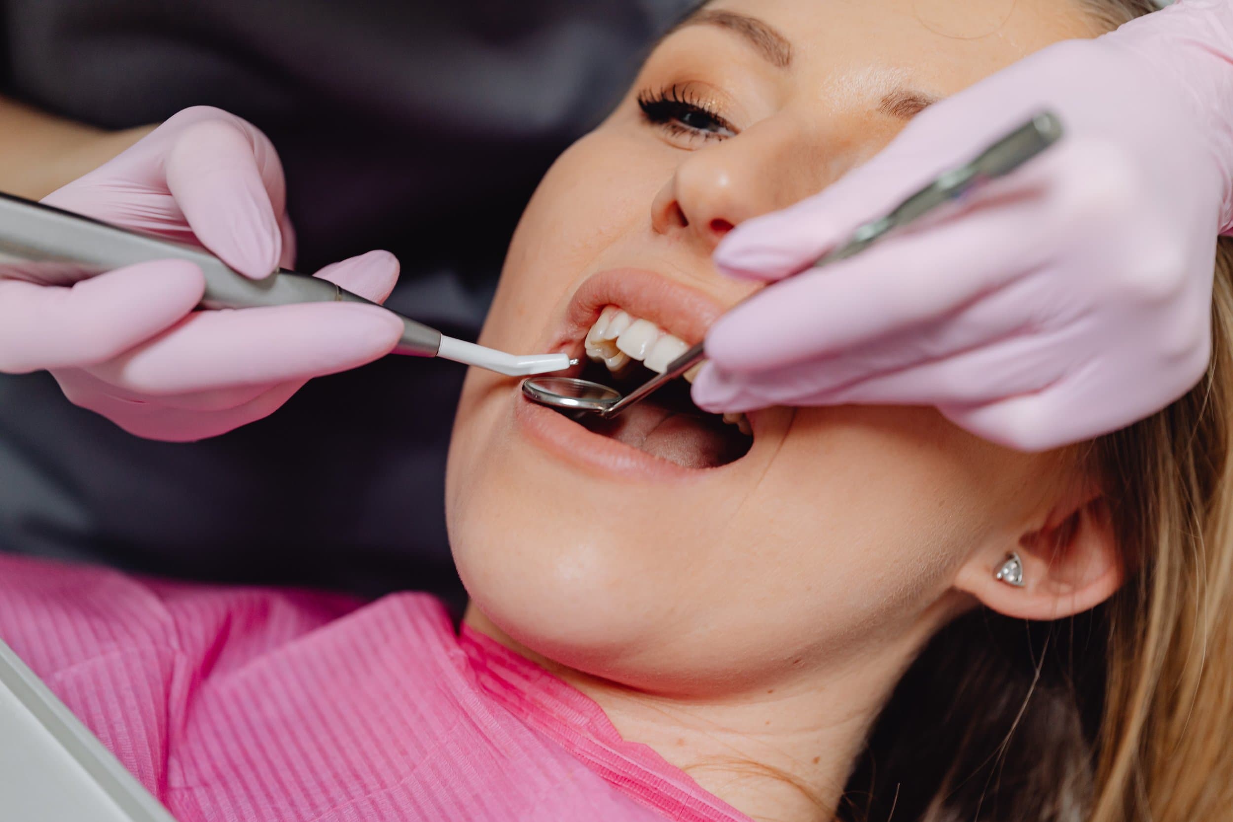 Healthy teeth and gums kept clean with regular scaling at Align Dental Surgery