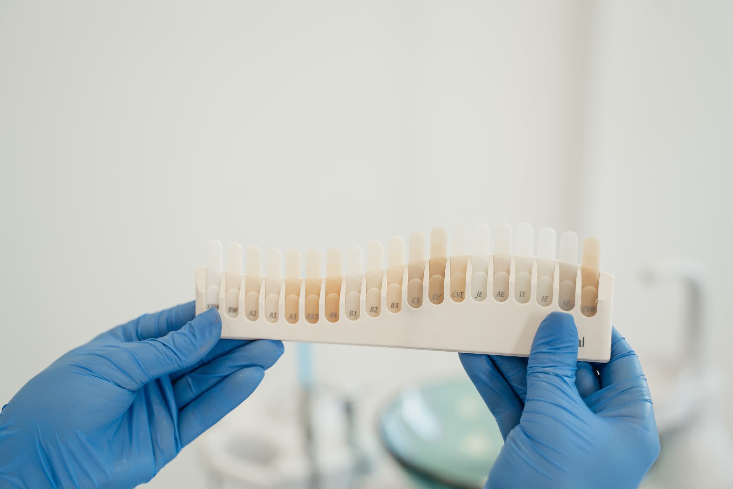 A custom take-home teeth whitening tray fitted at Align Dental Surgery, Orchard Road