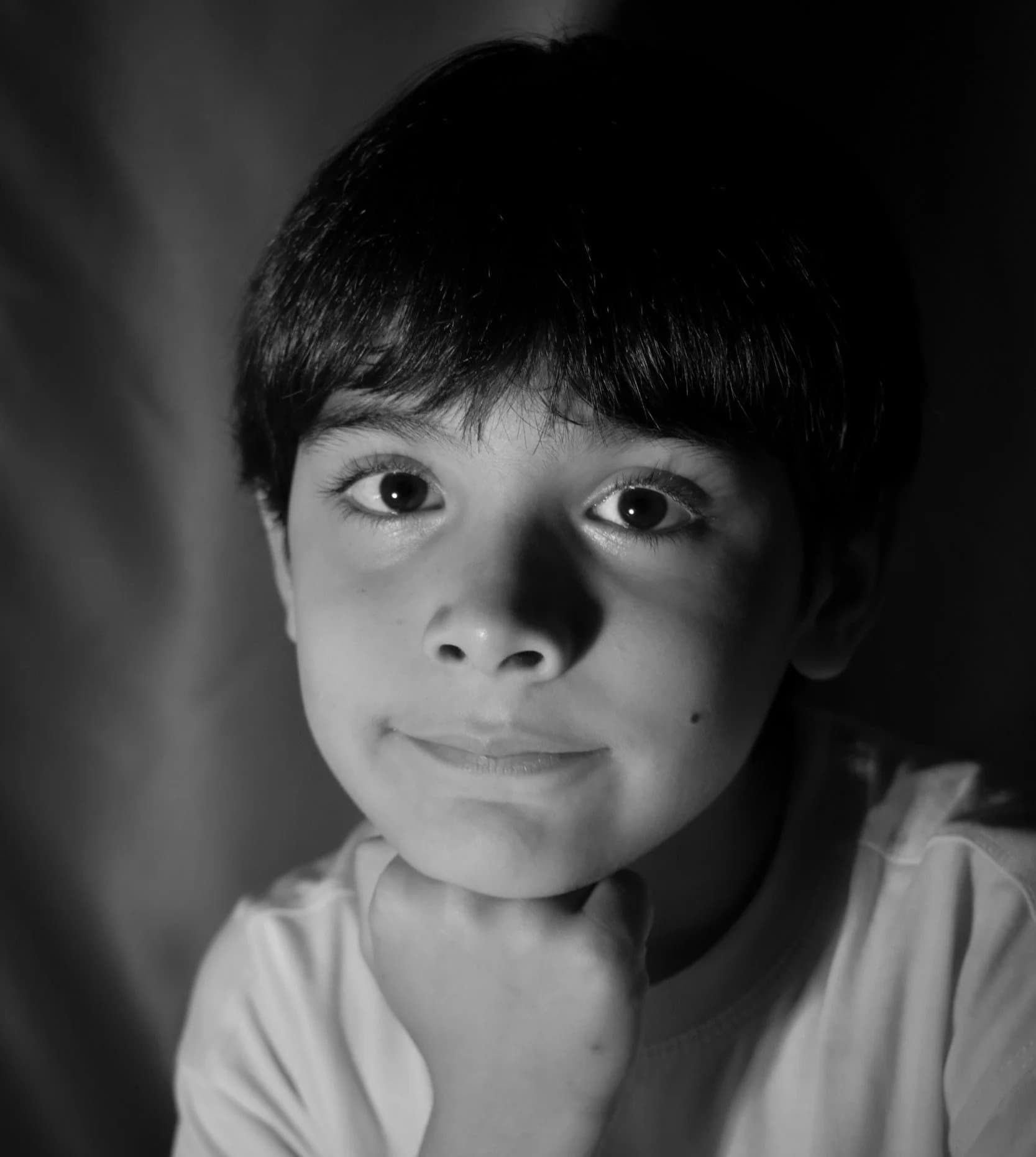A young child sleeping soundly, reflecting the restful sleep that healthy jaw and airway development supports, at Align Dental Surgery