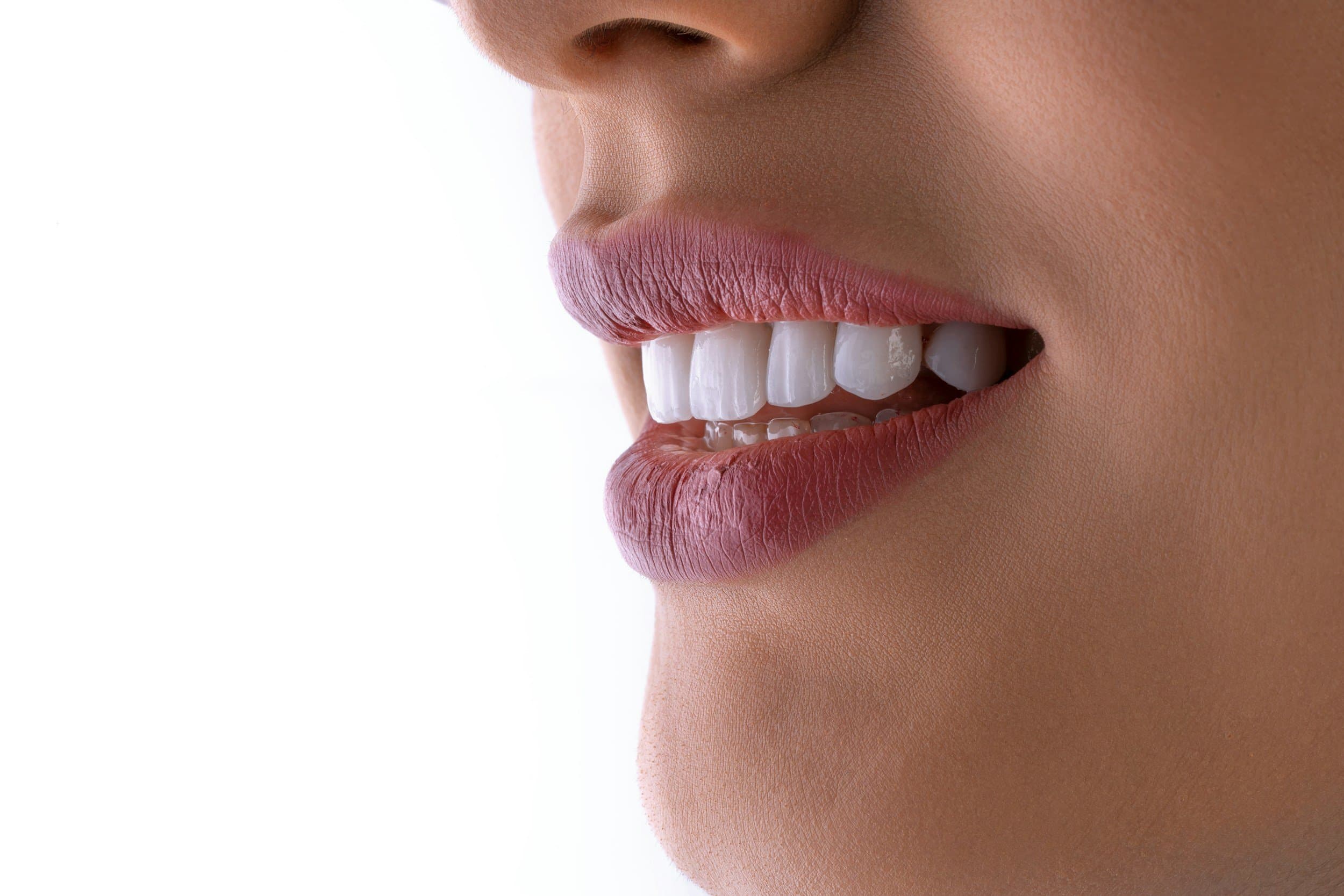 A close-up side profile of a smiling mouth wearing a clear retainer over the teeth, at Align Dental Surgery