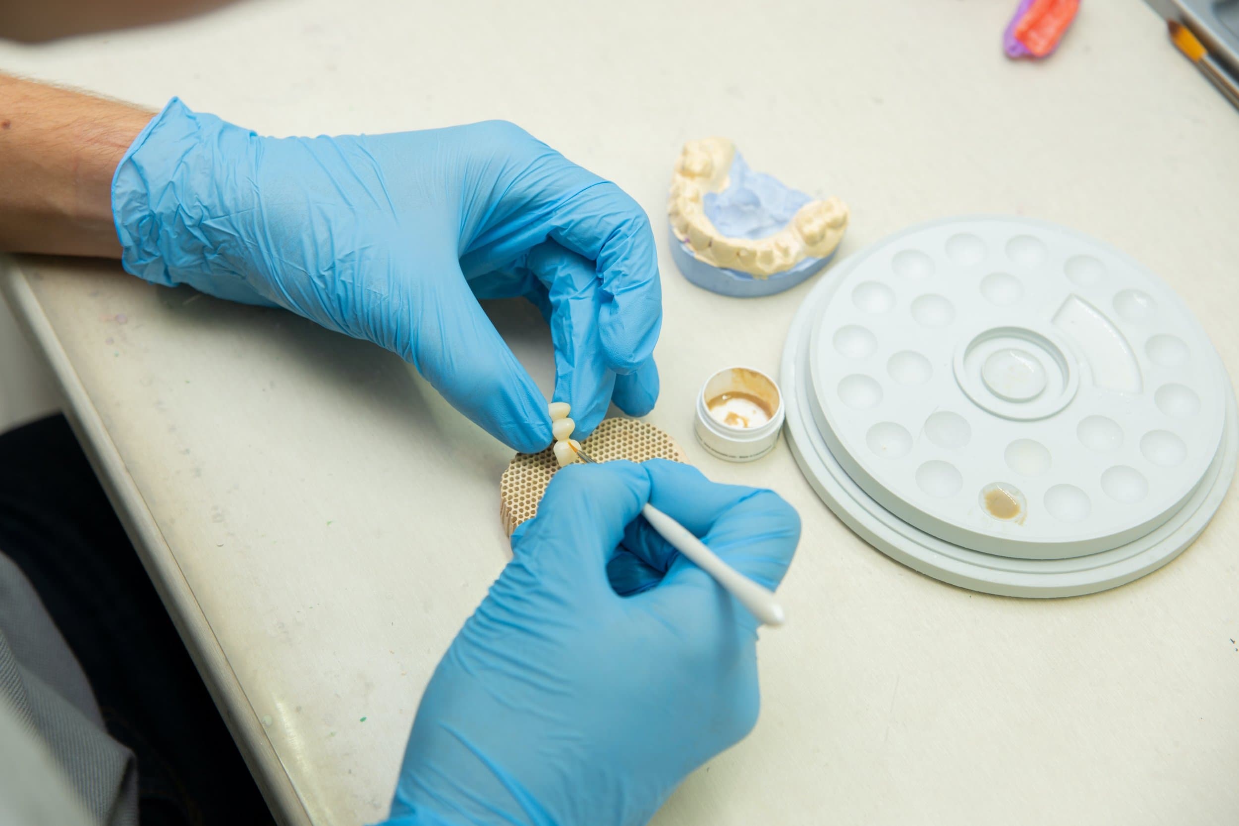 A thin porcelain dental veneer held in hand at Align Dental Surgery